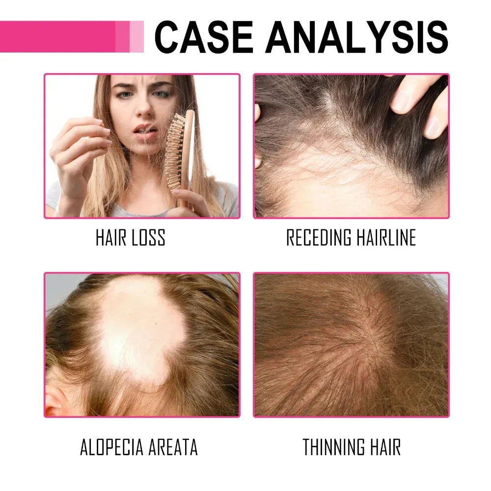 Moroccan Essential Hair Care Oil For Moisturizing And Repairing Dry And Frizz Hair