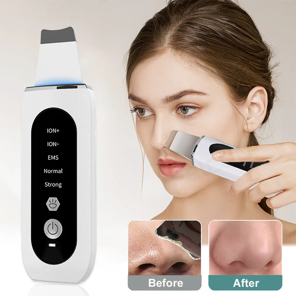 Ultrasonic Facial Skin Scrubber For Skin Care Acne & Blackhead Removal
