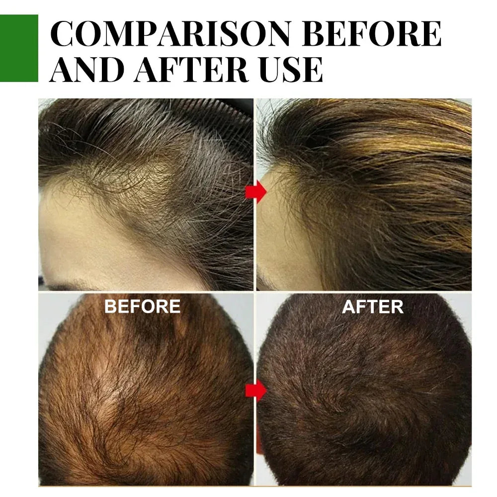 Rosemary Hair Care Essential Oil Anti Hair Loss Nourish Scalp Hair Roots For Growth