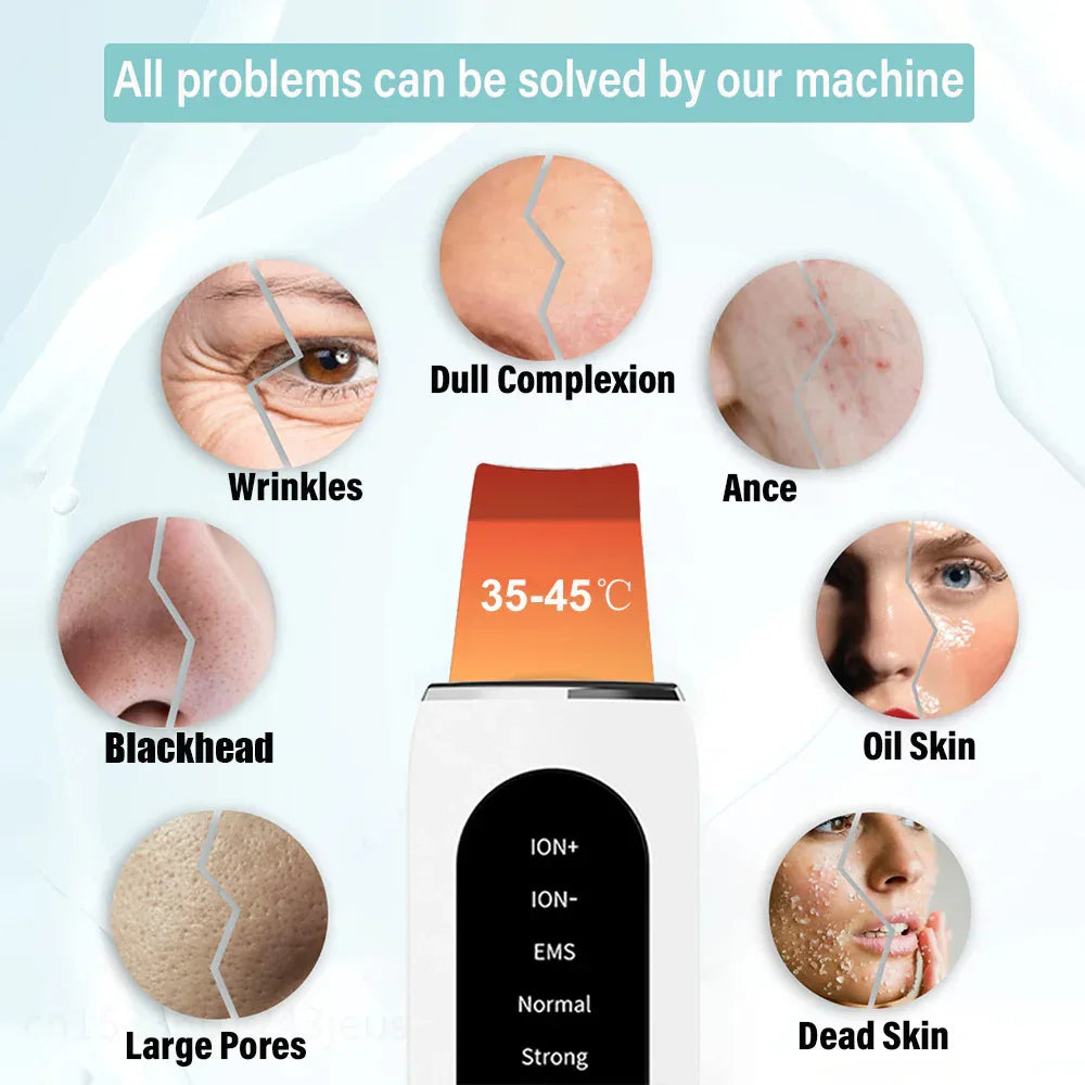 Ultrasonic Facial Skin Scrubber For Skin Care Acne & Blackhead Removal
