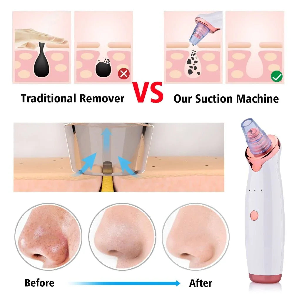 Electric Suction Blackhead Remover Skin Cleaning Device