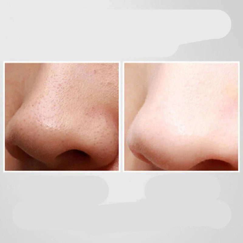 Ultrasonic Pore Cleaner Household Blackhead Remover
