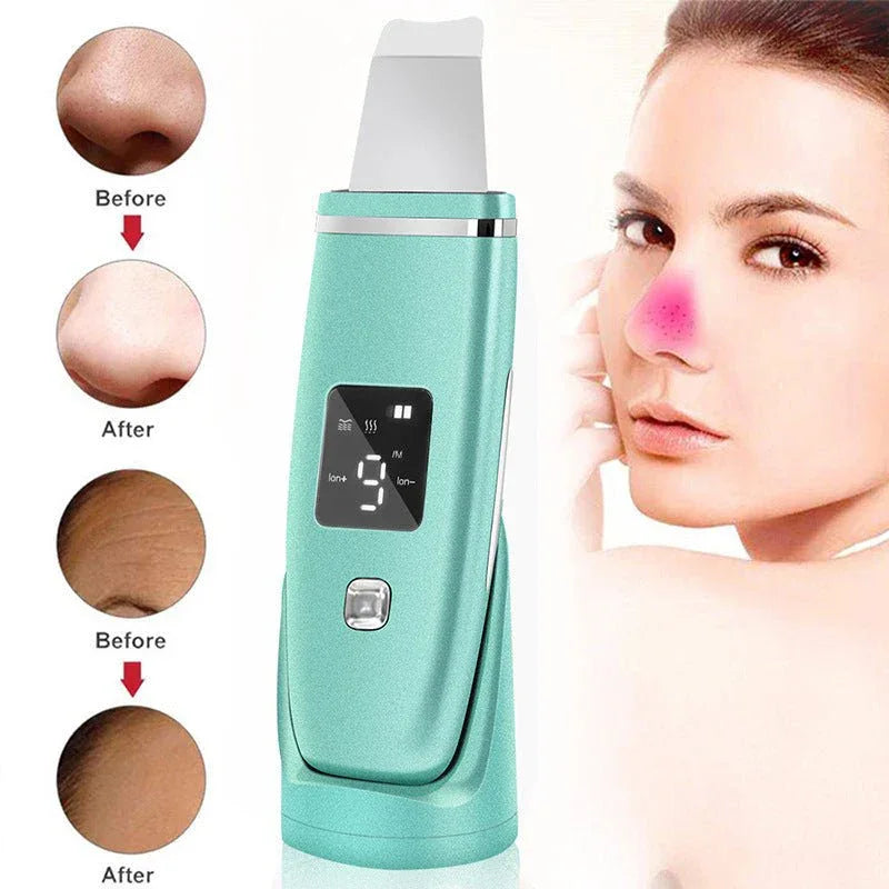 Ultrasonic Vibration Blackhead & Acne Removal Deep Cleansing Face Scrubber With Peeling Shovel