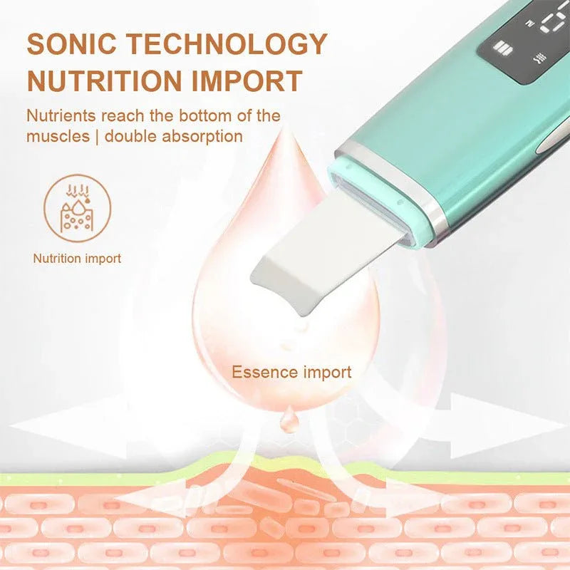 Ultrasonic Vibration Blackhead & Acne Removal Deep Cleansing Face Scrubber With Peeling Shovel